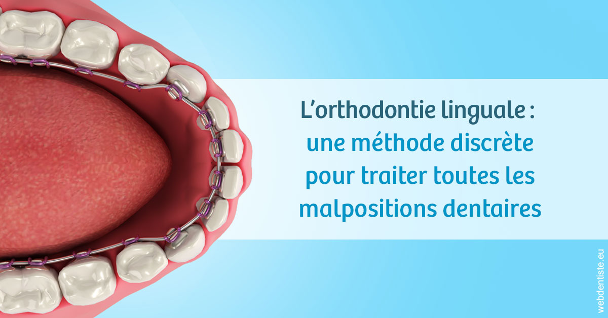 https://www.dentistes-bouaziz.fr/L'orthodontie linguale 1