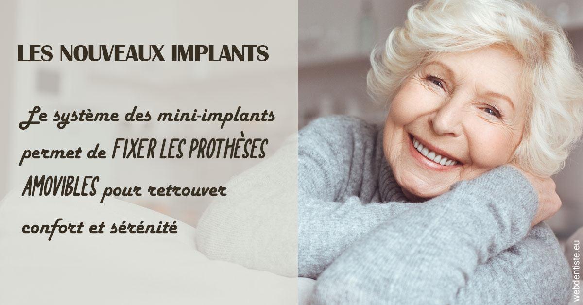 https://www.dentistes-bouaziz.fr/Les nouveaux implants 1
