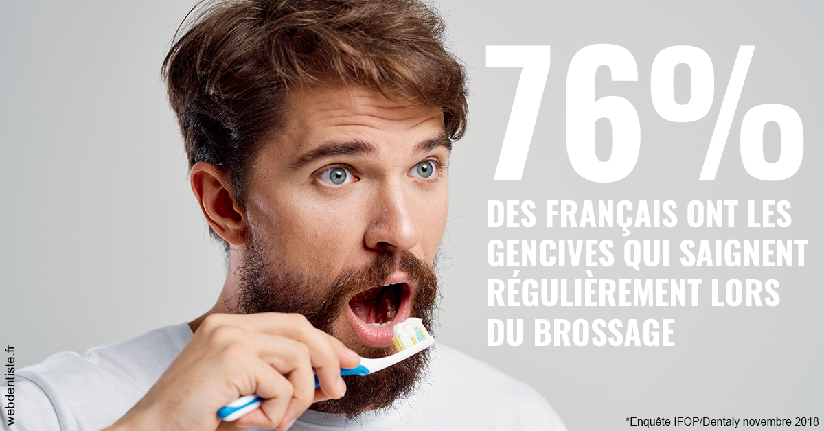https://www.dentistes-bouaziz.fr/76% des Français 2