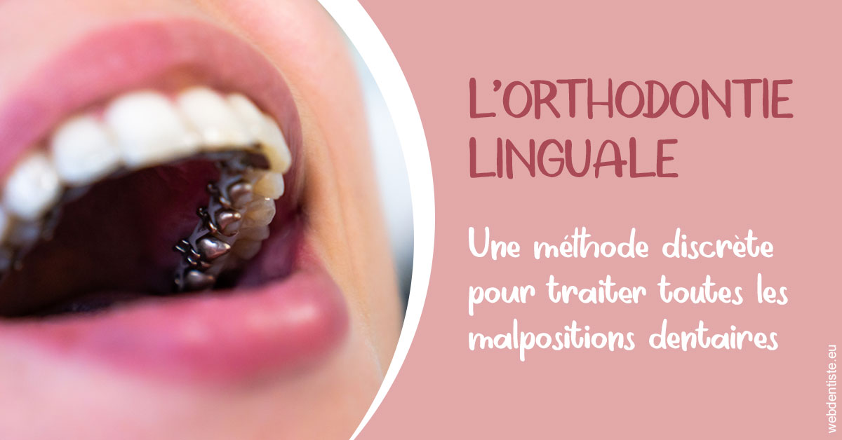 https://www.dentistes-bouaziz.fr/L'orthodontie linguale 2