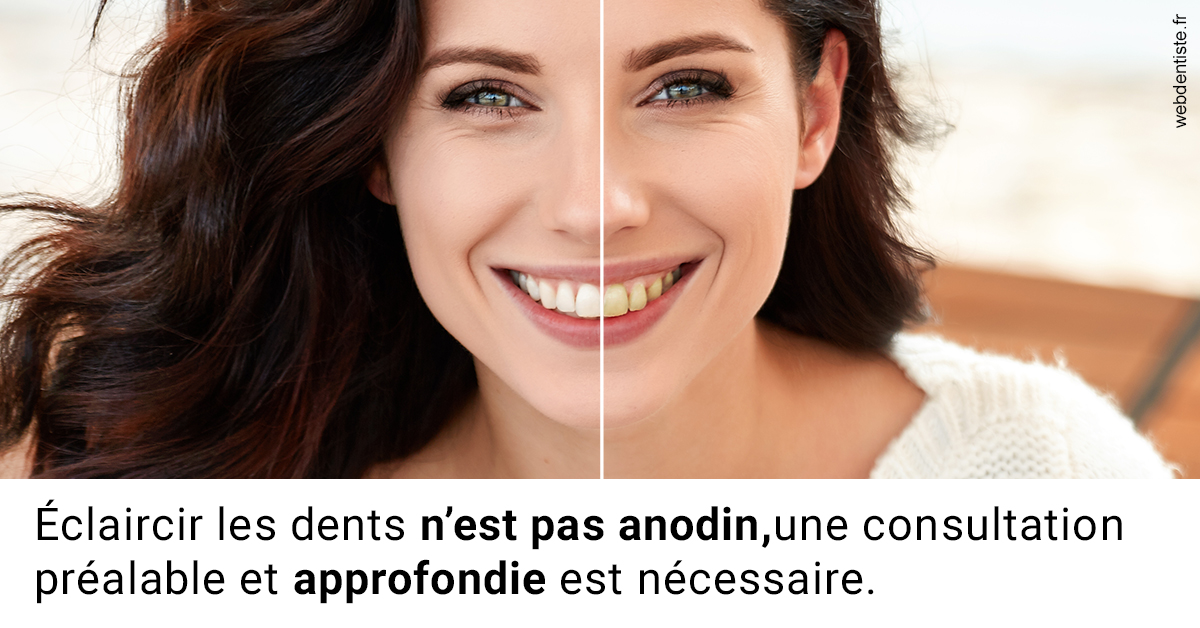 https://www.dentistes-bouaziz.fr/Le blanchiment 2