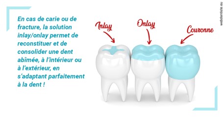https://www.dentistes-bouaziz.fr/L'INLAY ou l'ONLAY