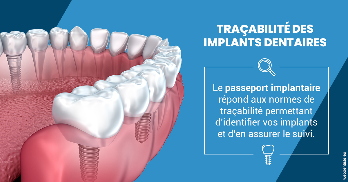 https://www.dentistes-bouaziz.fr/T2 2023 - Traçabilité des implants 1