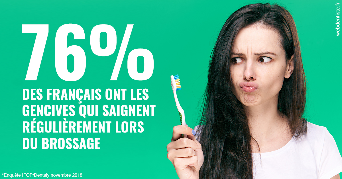 https://www.dentistes-bouaziz.fr/76% des Français 1
