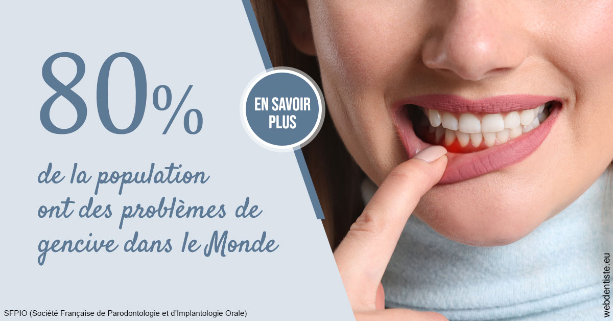 https://www.dentistes-bouaziz.fr/Problèmes de gencive 2
