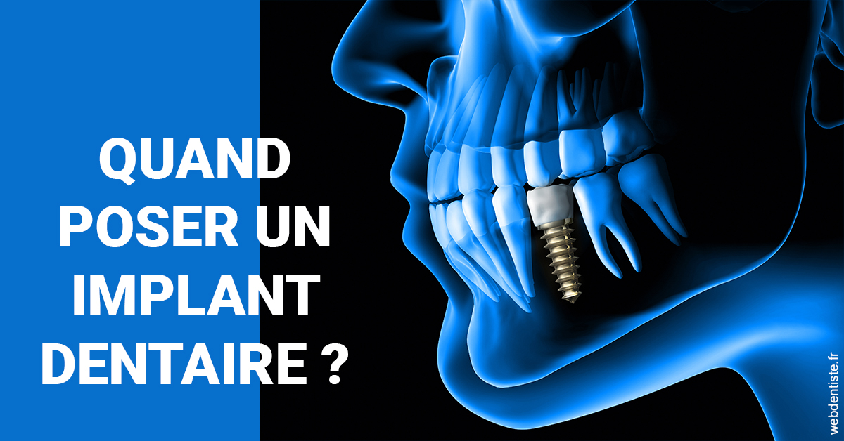 https://www.dentistes-bouaziz.fr/Les implants 1