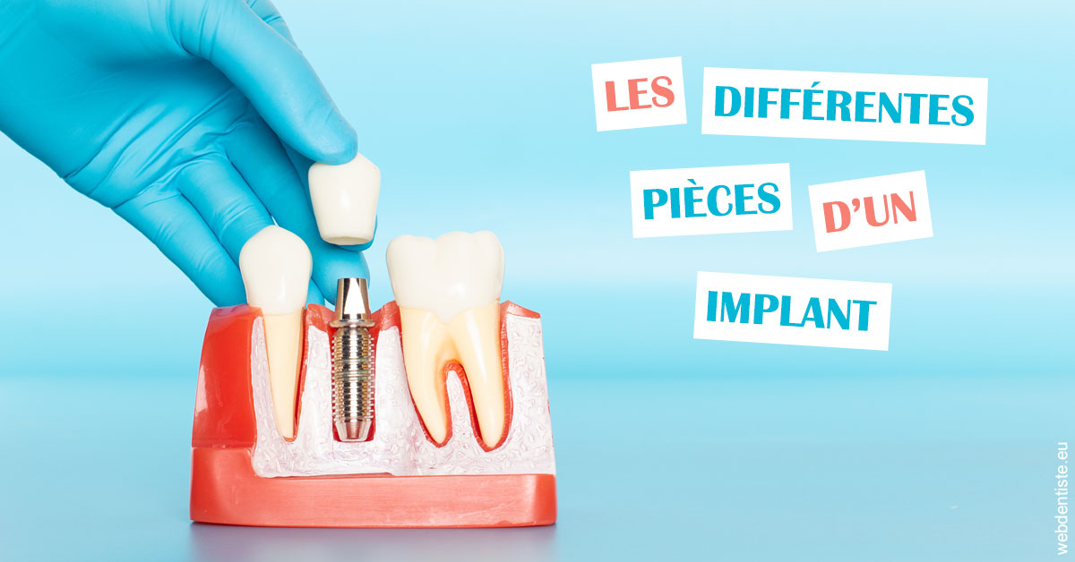 https://www.dentistes-bouaziz.fr/Les différentes pièces d’un implant 2