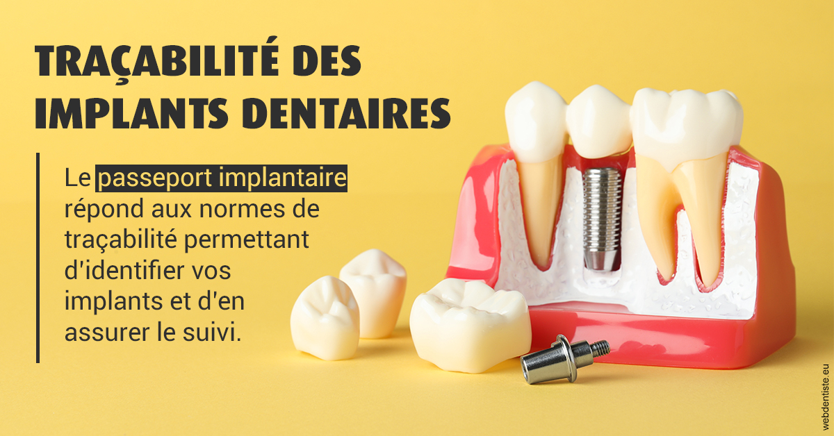 https://www.dentistes-bouaziz.fr/T2 2023 - Traçabilité des implants 2