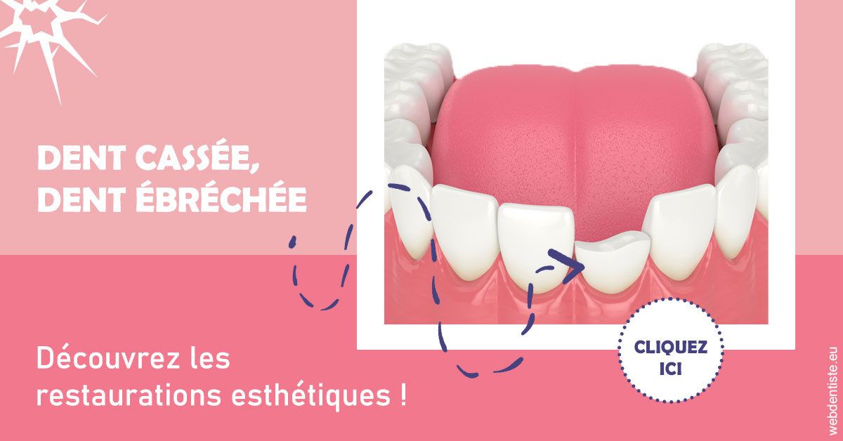 https://www.dentistes-bouaziz.fr/Dent cassée ébréchée 1