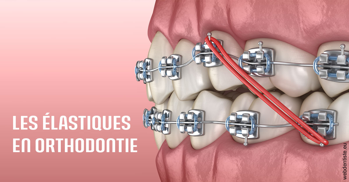 https://www.dentistes-bouaziz.fr/Elastiques orthodontie 2
