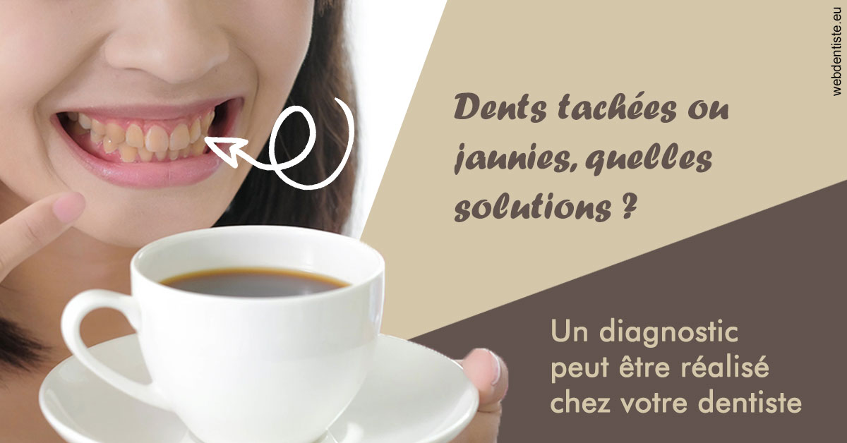 https://www.dentistes-bouaziz.fr/Dents tachées 1