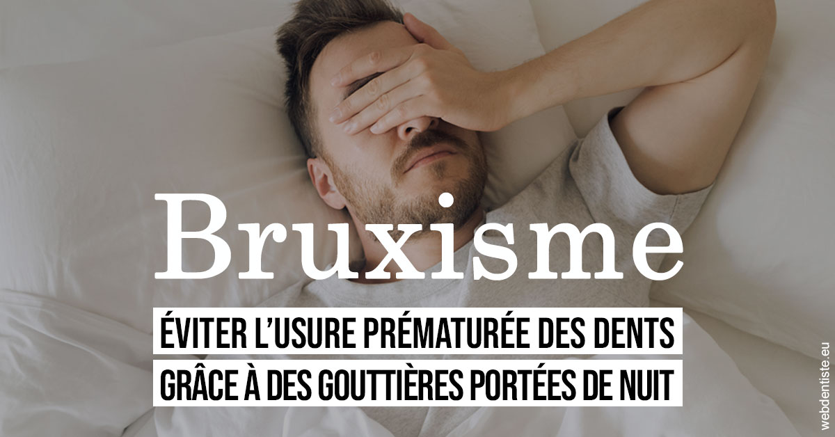 https://www.dentistes-bouaziz.fr/Bruxisme 1