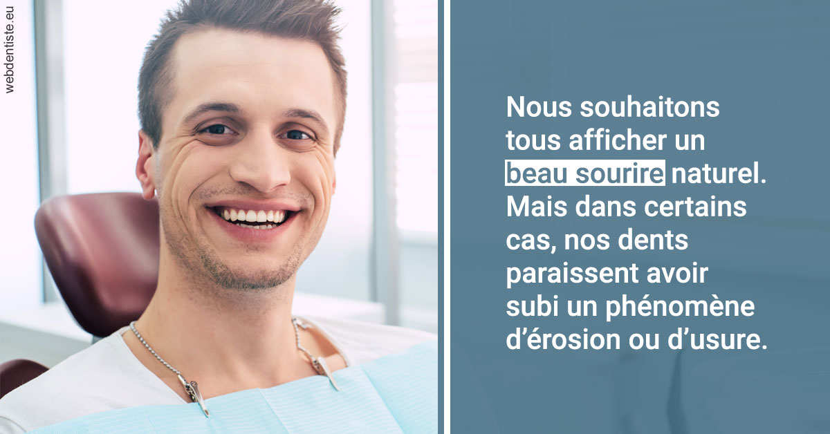 https://www.dentistes-bouaziz.fr/Érosion et usure dentaire