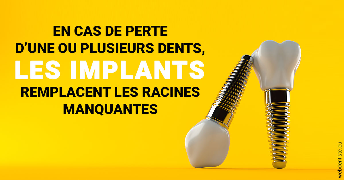 https://www.dentistes-bouaziz.fr/Les implants 2