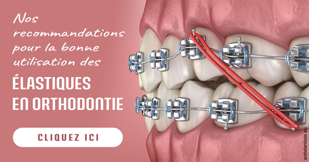 https://www.dentistes-bouaziz.fr/Elastiques orthodontie 2