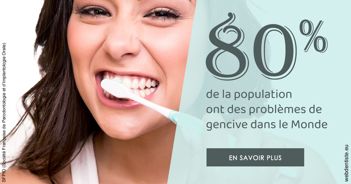 https://www.dentistes-bouaziz.fr/Problèmes de gencive 1